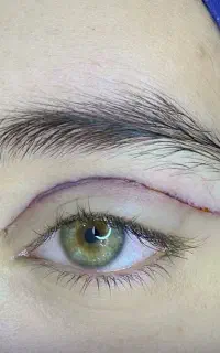 بلفارو ساکشن آفر ویژه بهاره