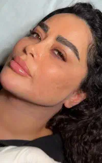 ساکشن غبغب