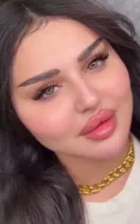 ژل وبوتاکس درکلینیک کربن تراپی هالیودی ۵۰۰
