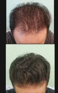 کاملا تضمین شده در کمتر از یک ماه