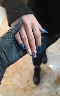 کاشت ناخن