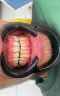 آموزش کامپوزیت ۹م و‌کلیه امور دندانپزشکی