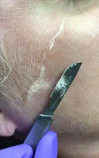 انجام خدمات درما و کاشت ناخون
