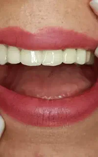 خدمات دندان پزشکی لبخند سفید