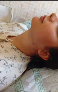 ساکشن و چربی وژل و بوتاکس و مزو