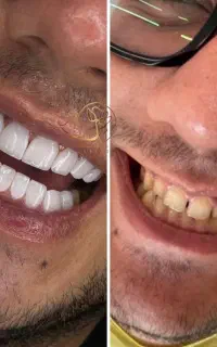 کلینیک زیبایی و کامپوزیت دندان تمام اقساط در شیراز