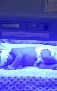 اجاره دستگاه زردی نوزاد
