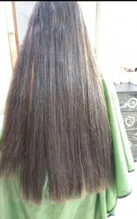 موخوره گیری و احیای مو