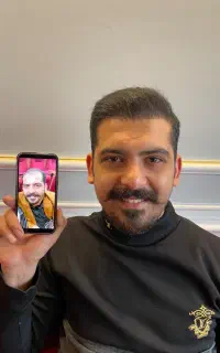 کاشت مو و ابرو بدون جراحی تضمینی با اقساط در تبریز