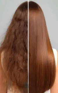 موخوره گیری مدرن