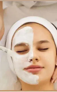 آموزش فیشال و پاکسازی (تخفیف ویژه )