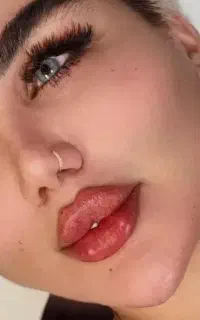 آف ویژه ژل لب فیلر بدن،بوتاکس+چالگونه+پیرسینگ+لیفت