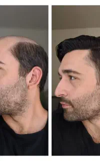 موهات دوباره جون میگیره
