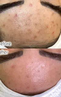 فیشال و پاکسازی