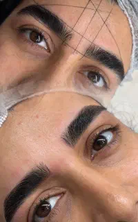 اصلاح تخصصی ابرو