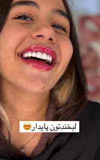 کامپوزیت اورجینال شروع از هر فک ۷/۸۰۰