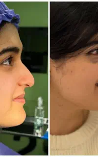 جشنواره بهاره عمل بینی