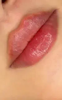 ژل،بوتاکس،مزوتراپی،خالبرداری،پیرسینگ