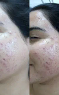فیشال و کربوکسی عیدانه با تخفیف ویژه