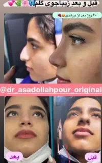 عمل  بینی    دکتر اسد الله پور     فقط(29.500)