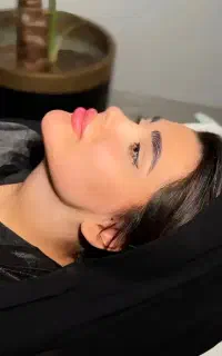 لیپو ساکشن غبغب با متدوی لاین تزریق چربی و هیپ دیپ