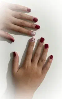 کاشت ناخن