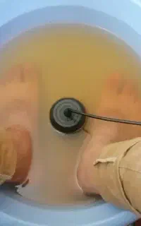 حجامت و بادکش و سم زدایی و یون تراپی با دستگاه