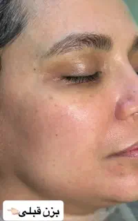 خدمات پوستی ویژه خانم ها واقایان در کلینیک زیبایی