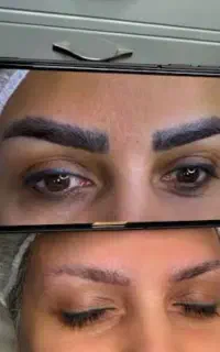ریمووتخصصی تک جلسه تتودرکلینیک ابروخط لب خط چشم