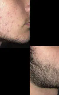 رویش صد درصدی طی ۳۰ روز