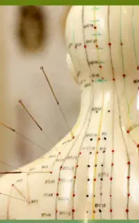 آموزش طب سوزنی در اصفهان/مدرک