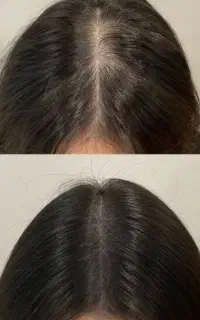 پرونده PRP رو برای همیشه ببنید