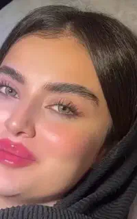 تزریق فیلر بوتاکل تمام نقاط بدن