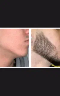 تقویت ریشه ریش و سبیل