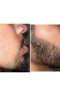 ریشاتو پرپشت کن