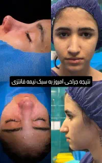 آفر داغ جراحی بینی فقط 34تومن