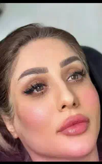 جشنواره،ژل،فیلر بادی تضمینی،مزوفیلرصورت تخصصی دقیق