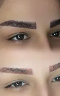 فیبروز، میکرو