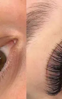کاشت مژه
