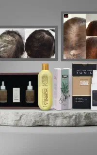 تونیک هیرفرند ،اکسونیک و لوشن و مورینگا