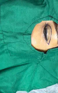 بلفاروپلاستی/ساکشن غب غب /دایرکت ابرو/ابدو و مینی