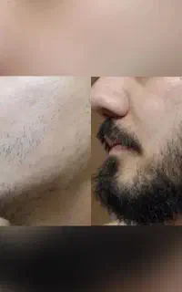 بدون درد خونریزی دربیار