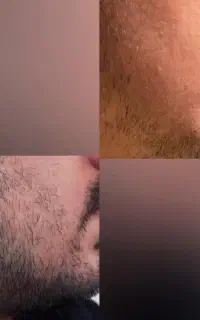 اگه میخوای صورتت ریش دار بشه