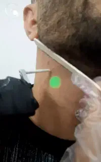 مرکز لیزر دکا