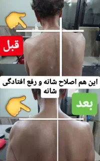 اصلاحی درمانی. رگگیری. زالودرمانی. حجامت