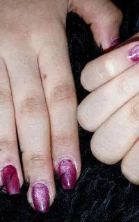 کاشت ناخن