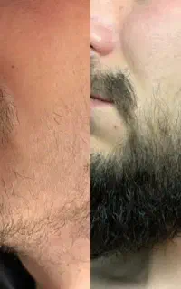 از نتیجه شگفت زده میشی