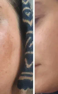 تخفیفات کرم اقای زارعی
