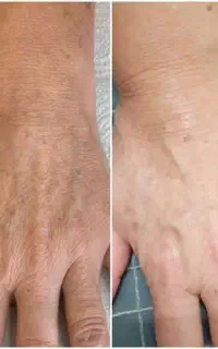 پاک کننده قوی لکّه ص و ر ت
