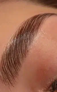 کاشت مژه به مدت محدود